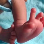 Pictures of Indian baby born with 26 fingers and toes surfaces online