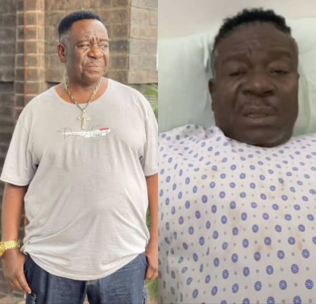 Mr. Ibu Completes Surgeries in Nigeria, to Receive Further Treatment Abroad