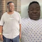 Mr. Ibu Completes Surgeries in Nigeria, to Receive Further Treatment Abroad