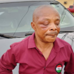 NLC President Joe Ajaero rushed to Hospital after being Beaten to Stupor