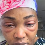 Mercy Aigbe Recounts Harrowing Eye Infection Experience on Set of Thin Line